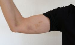 Belediye başkan yardımcısı ve meclis üyesinin vatandaşı darp ettiği iddiası