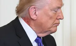 Boynunda gizemli leke! Trump’ın sağlığı yeniden tartışma konusu oldu