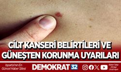 CİLT KANSERİ BELİRTİLERİ VE GÜNEŞTEN KORUNMA UYARILARI