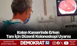 Kolon Kanserinde Erken Tanı İçin Düzenli Kolonoskopi Uyarısı
