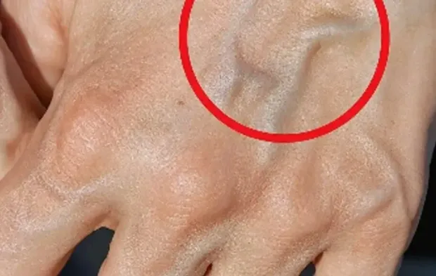 Damarlarınız böyle ise…