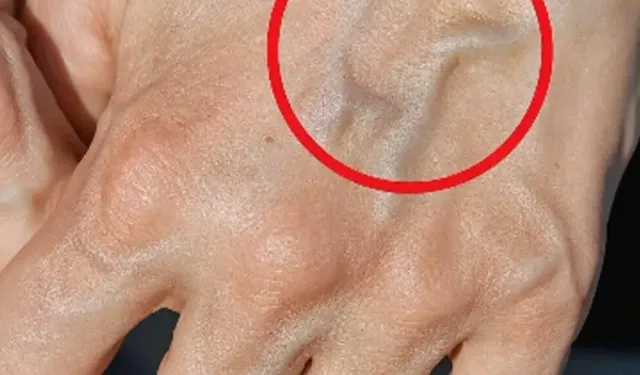 Damarlarınız böyle ise…