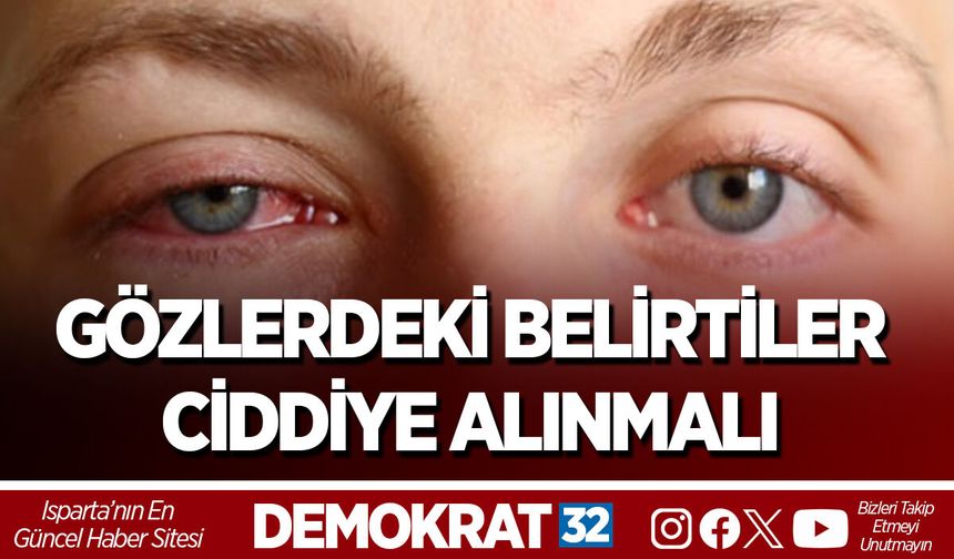 GÖZLERDEKİ BELİRTİLER CİDDİYE ALINMALI