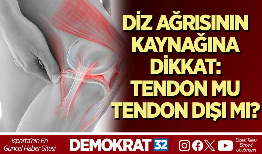 DİZ AĞRISININ KAYNAĞINA DİKKAT: TENDON MU, TENDON DIŞI MI?