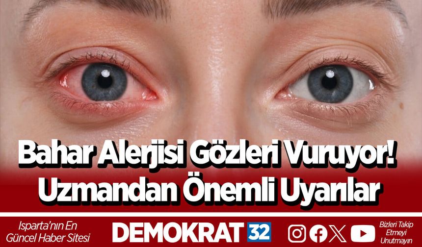 Bahar Alerjisi Gözleri Vuruyor! Uzmandan Önemli Uyarılar