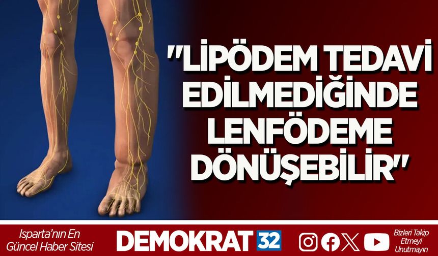 "LİPÖDEM TEDAVİ EDİLMEDİĞİNDE LENFÖDEME DÖNÜŞEBİLİR"
