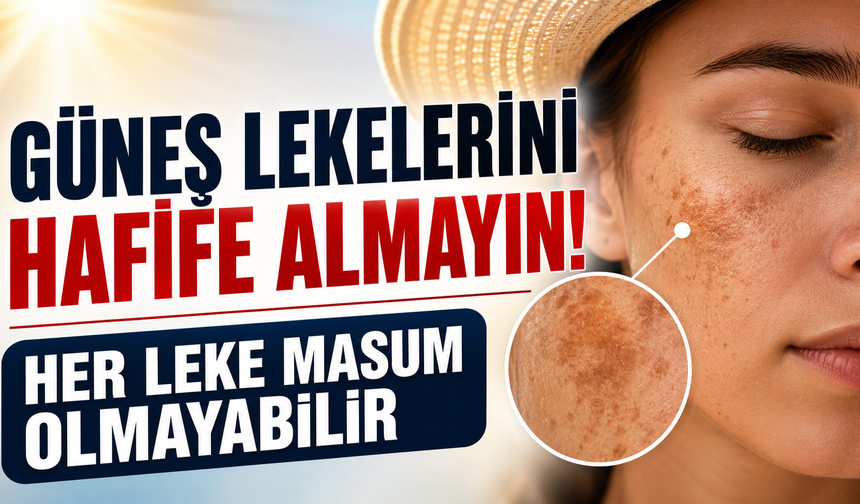 Güneş Lekelerini Hafife Almayın: Her Leke Masum Olmayabilir
